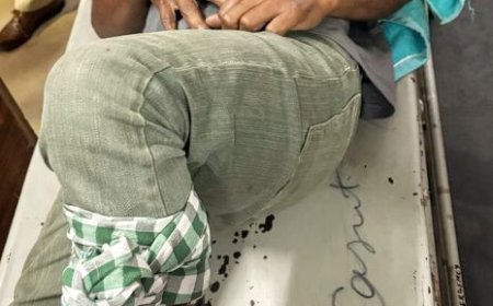 Notorious criminal injured in encounter in Sambalpur